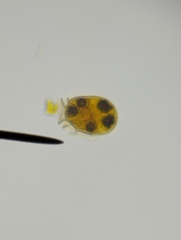Dinophysis - Photo (c) Paula Catasús, some rights reserved (CC BY-NC), uploaded by Paula Catasús