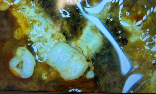Pomatoceros triqueter