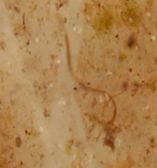 Annelida