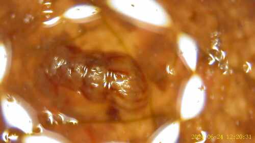 Caracoles, babosas y otros parientes