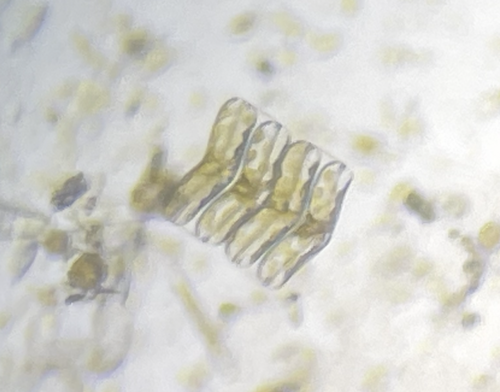 Diatoms
