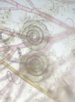 Foraminifers