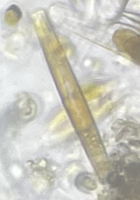 Diatoms