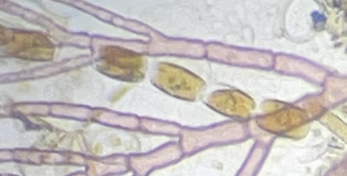 Diatoms